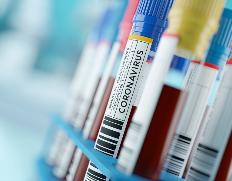 Coronavirus: Details Matter